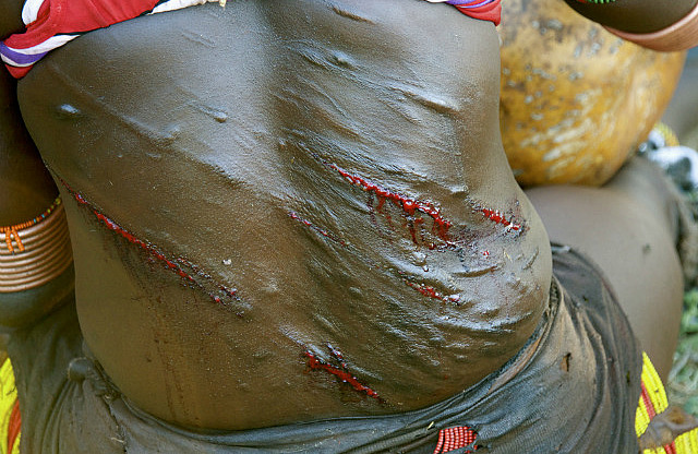 5.1386421339.scars-of-love